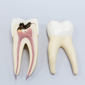 Endodontie